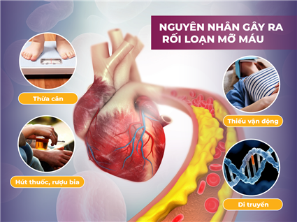 [TỌA ĐÀM GIÁ NHƯ SỐ 01] NGUYÊN NHÂN GÂY RỐI LOẠN MỠ MÁU