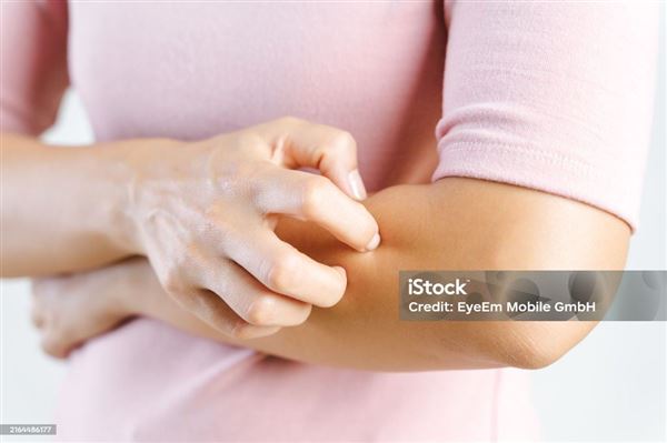 Những điều cần biết về Lupus 